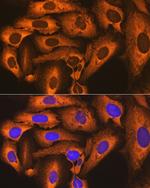 FKBP4 Antibody in Immunocytochemistry (ICC/IF)