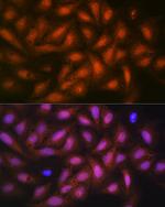 PP1 beta Antibody in Immunocytochemistry (ICC/IF)