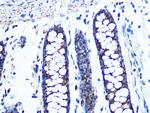 UQCRC2 Antibody in Immunohistochemistry (Paraffin) (IHC (P))