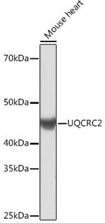 UQCRC2 Antibody in Western Blot (WB)