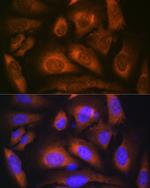 Laminin beta-1 Antibody in Immunocytochemistry (ICC/IF)