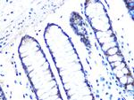 14-3-3 sigma Antibody in Immunohistochemistry (Paraffin) (IHC (P))