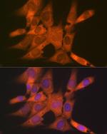 Tetranectin Antibody in Immunocytochemistry (ICC/IF)