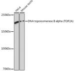 TOP2A Antibody in Western Blot (WB)