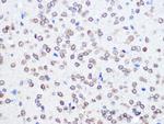 UBC9 Antibody in Immunohistochemistry (Paraffin) (IHC (P))