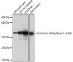 Carbonic Anhydrase I Antibody in Western Blot (WB)