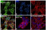 CRMP2 Antibody in Immunocytochemistry (ICC/IF)