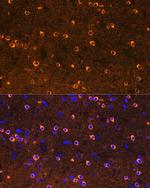 CRMP2 Antibody in Immunohistochemistry (Paraffin) (IHC (P))