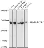 CRMP2 Antibody in Western Blot (WB)