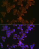 Apolipoprotein L1 Antibody in Immunocytochemistry (ICC/IF)