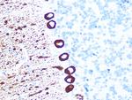 IP3 Receptor 1 Antibody in Immunohistochemistry (Paraffin) (IHC (P))