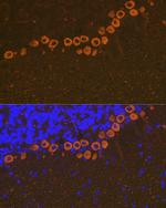 IP3 Receptor 1 Antibody in Immunohistochemistry (Paraffin) (IHC (P))