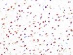 PRMT1 Antibody in Immunohistochemistry (Paraffin) (IHC (P))