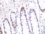 PRMT1 Antibody in Immunohistochemistry (Paraffin) (IHC (P))