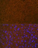 Protein C Antibody in Immunohistochemistry (Paraffin) (IHC (P))