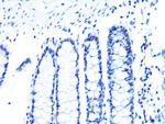 U2AF2 Antibody in Immunohistochemistry (Paraffin) (IHC (P))