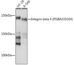 CD104 Antibody in Western Blot (WB)