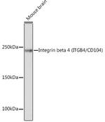 CD104 Antibody in Western Blot (WB)