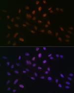MTA2 Antibody in Immunocytochemistry (ICC/IF)