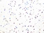 MAD2L2 Antibody in Immunohistochemistry (Paraffin) (IHC (P))