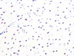 MAD2L2 Antibody in Immunohistochemistry (Paraffin) (IHC (P))