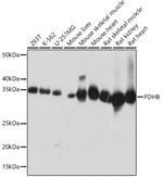 PDHB Antibody in Western Blot (WB)