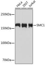 SMC1 Antibody in Western Blot (WB)