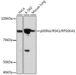 RSK1 Antibody in Western Blot (WB)