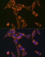 Galectin 1 Antibody in Immunocytochemistry (ICC/IF)