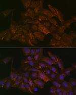 Pan Ras Antibody in Immunocytochemistry (ICC/IF)