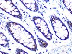 PDK2 Antibody in Immunohistochemistry (Paraffin) (IHC (P))