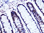 GTPBP4 Antibody in Immunohistochemistry (Paraffin) (IHC (P))