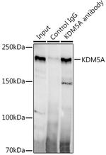 KDM5A Antibody in Immunoprecipitation (IP)