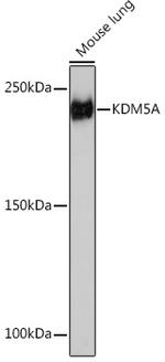 KDM5A Antibody in Western Blot (WB)