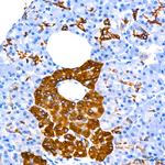 Cytokeratin 7 Antibody in Immunohistochemistry (Paraffin) (IHC (P))