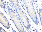 MUC2 Antibody in Immunohistochemistry (Paraffin) (IHC (P))