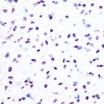 Hydroxyl-Histone H2A (Tyr39) Antibody in Immunohistochemistry (Paraffin) (IHC (P))