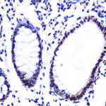 Hydroxyl-Histone H2A (Tyr39) Antibody in Immunohistochemistry (Paraffin) (IHC (P))