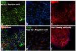 TSPO Antibody in Immunocytochemistry (ICC/IF)