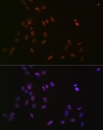 ASH2L Antibody in Immunocytochemistry (ICC/IF)