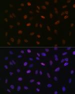 ASH2L Antibody in Immunocytochemistry (ICC/IF)