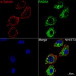 RAB9 Antibody in Immunocytochemistry (ICC/IF)