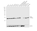 RAB9 Antibody in Western Blot (WB)