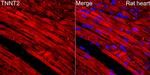 Cardiac Troponin T Antibody in Immunohistochemistry (Paraffin) (IHC (P))