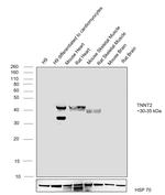 Cardiac Troponin T Antibody