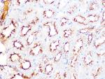 Clathrin Heavy Chain Antibody in Immunohistochemistry (Paraffin) (IHC (P))