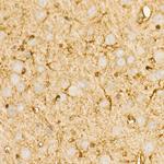 PI3K p85 alpha Antibody in Immunohistochemistry (Paraffin) (IHC (P))