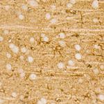 PI3K p85 alpha Antibody in Immunohistochemistry (Paraffin) (IHC (P))