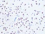 OGG1 Antibody in Immunohistochemistry (Paraffin) (IHC (P))