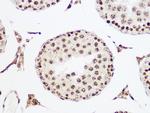 MCM5 Antibody in Immunohistochemistry (Paraffin) (IHC (P))